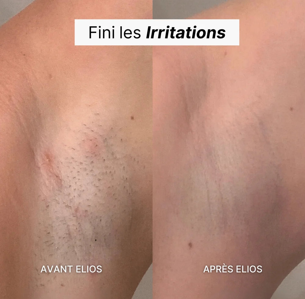 Rasoir 5-en-1 ELIOS®