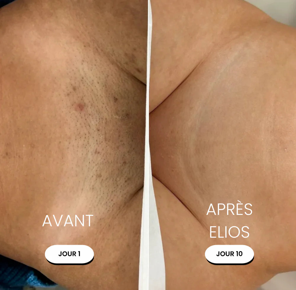Rasoir 5-en-1 ELIOS®
